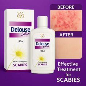 Delouse Lotion