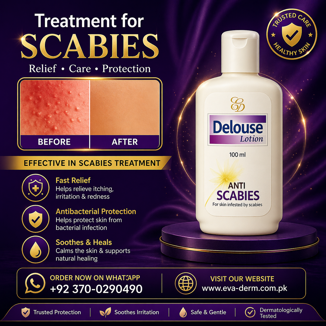 Delouse Lotion - Image 3